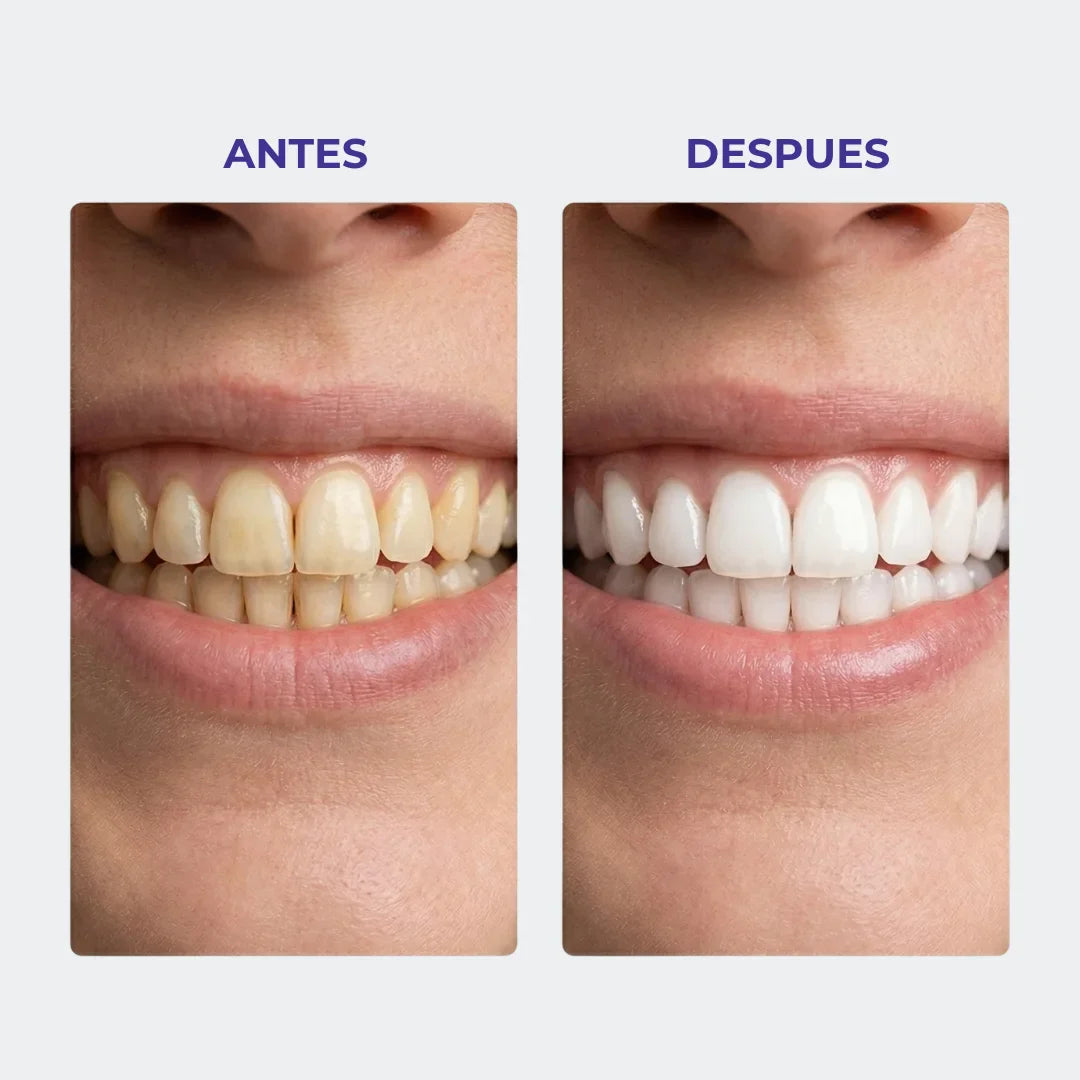 🧠Dientes más blancos en 7 días  🧠