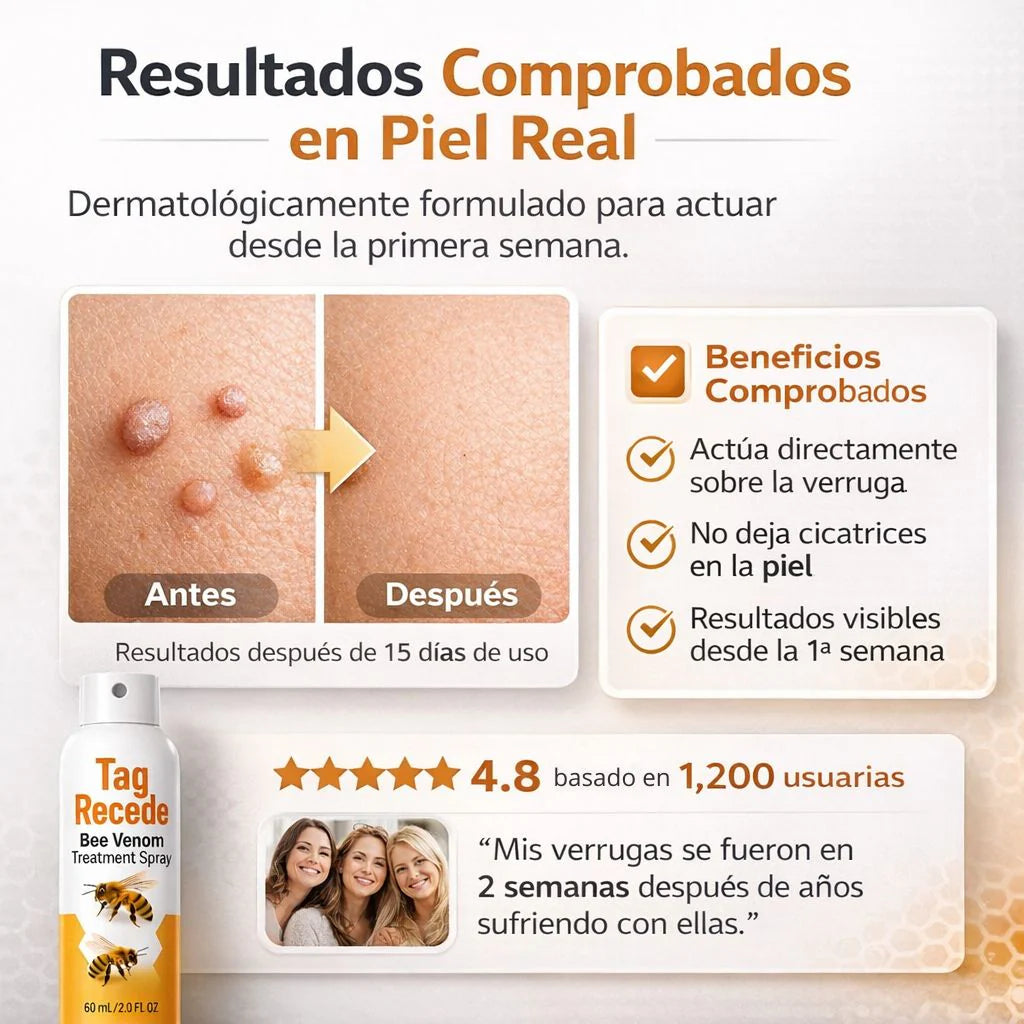 Spray eliminador de verrugas Tag Recede | 60 ML